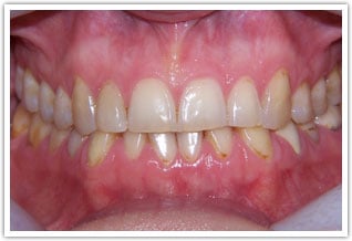 case1-b