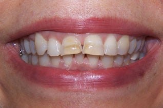 unattractive teeth