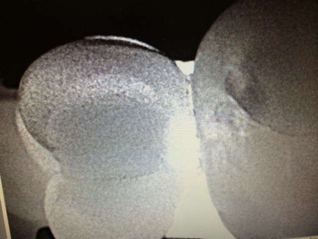 infrared imaging can be used in planning your treatment
