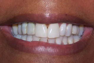 unattractive teeth