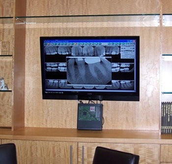 television displaying xrays
