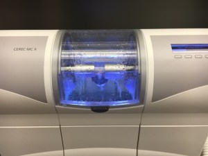 CEREC Milling Unit allows restorations to be made in-house