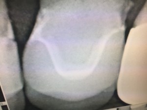 CEREC allows for in-house planning of your treatment